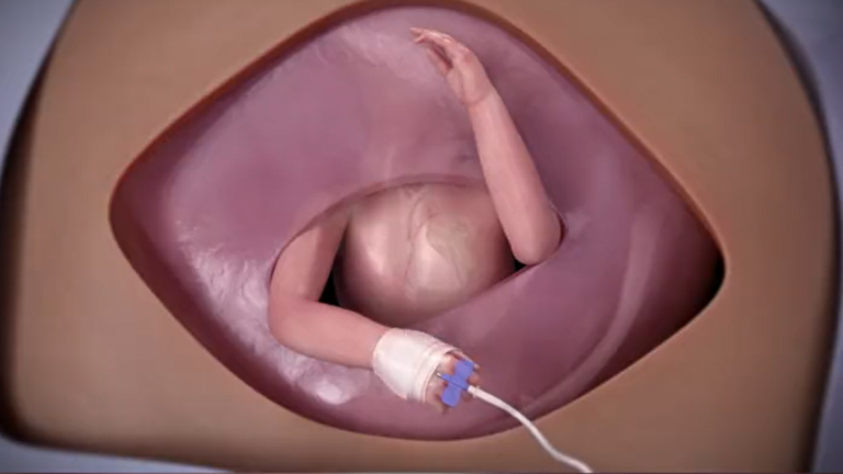 جانب من الجراحة المعقدة