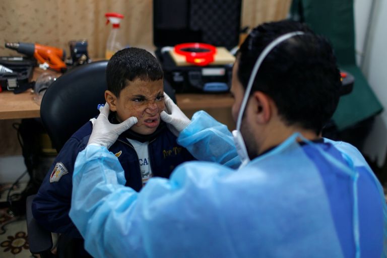 أقنعة ثلاثية الأبعاد لضحايا حروق الوجه في غزة