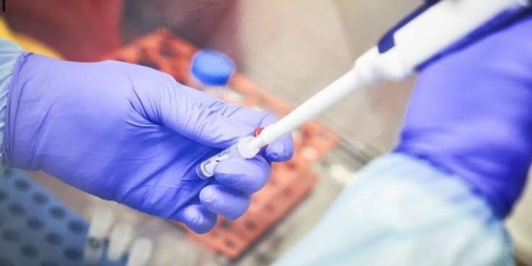 فحص كورونا في الإمارات فحص كورونا في الإمارات