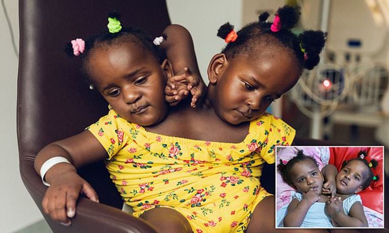 التوأم الملتصق مريم وندى ندياي