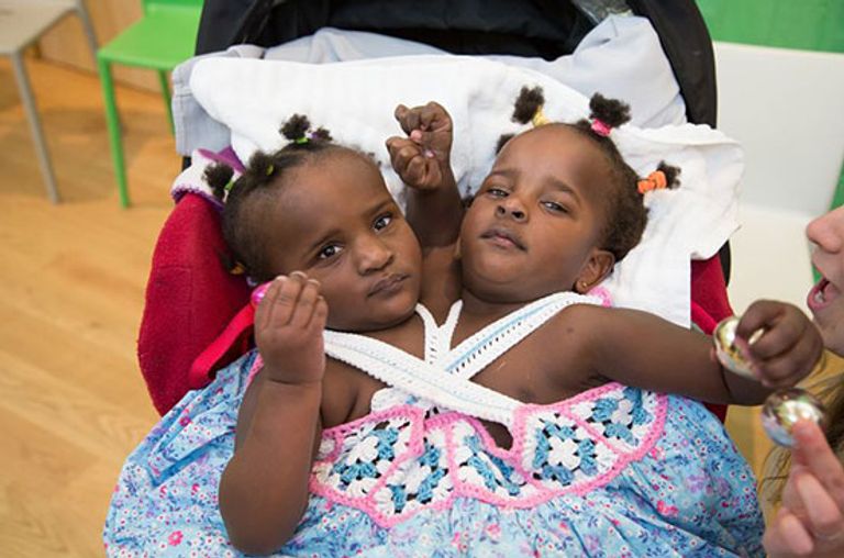 التوأم الملتصق مريم وندى ندياي