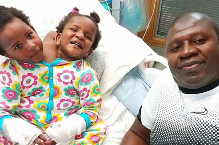 التوأم الملتصق مريم وندى ندياي