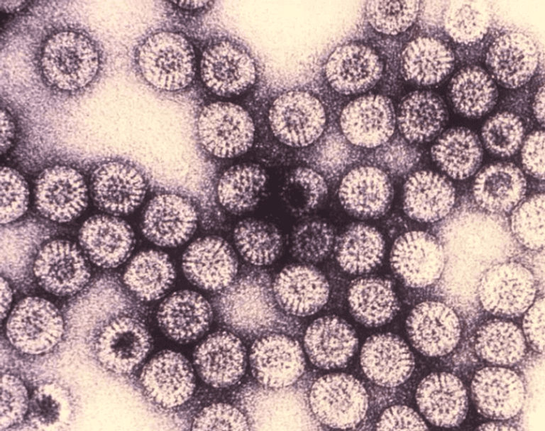 شكل فيروس كوفيد-19 تحت المجهر