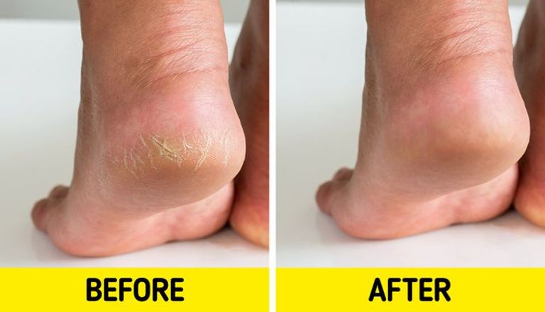 جوليا روبرتس تستخدم زيت الزيتون لبشرتها