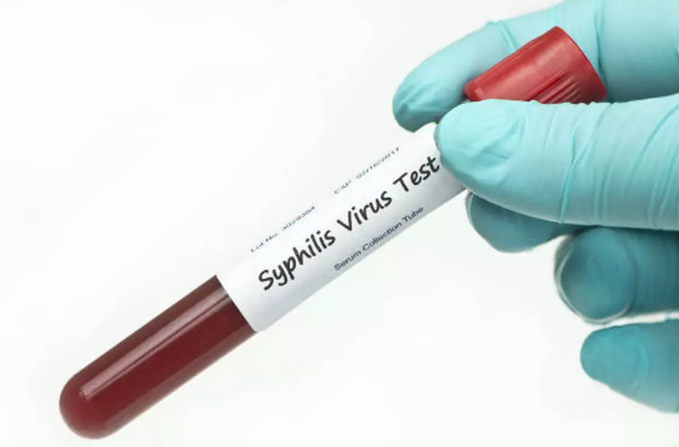 علاج مرض الزهري التناسلي مرض الزهري