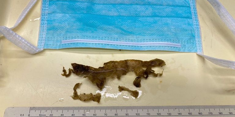 قناع وجه ملقى على الأرض مهددا بنقل فيروس كورونا