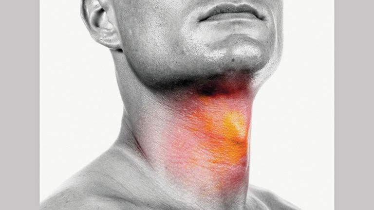 الإنزيم ينشط ويساعد على نمو الخلايا السرطانية - تعبيرية