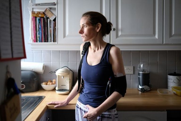 البريطانية آن ماري ويليامز والدة التوأم المعجزة