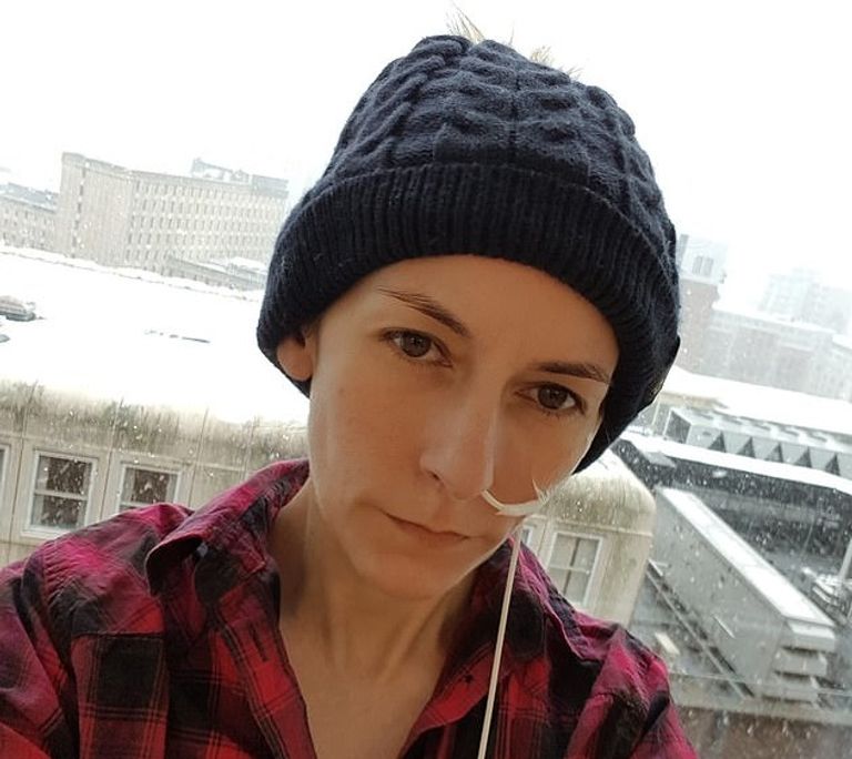 البريطانية آن ماري ويليامز والدة التوأم المعجزة