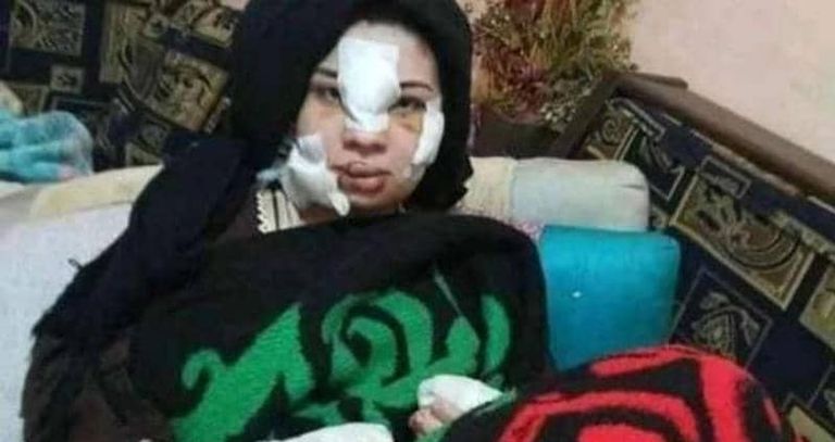 إسراء عماء بعد الاعتداء عليها إسراء عماد بعد الاعتداء عليها