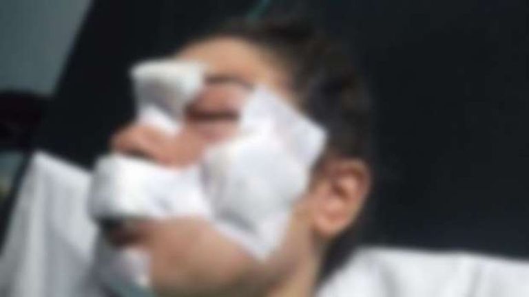 إسراء عماء بعد الاعتداء عليها إسراء عماد بعد الاعتداء عليها