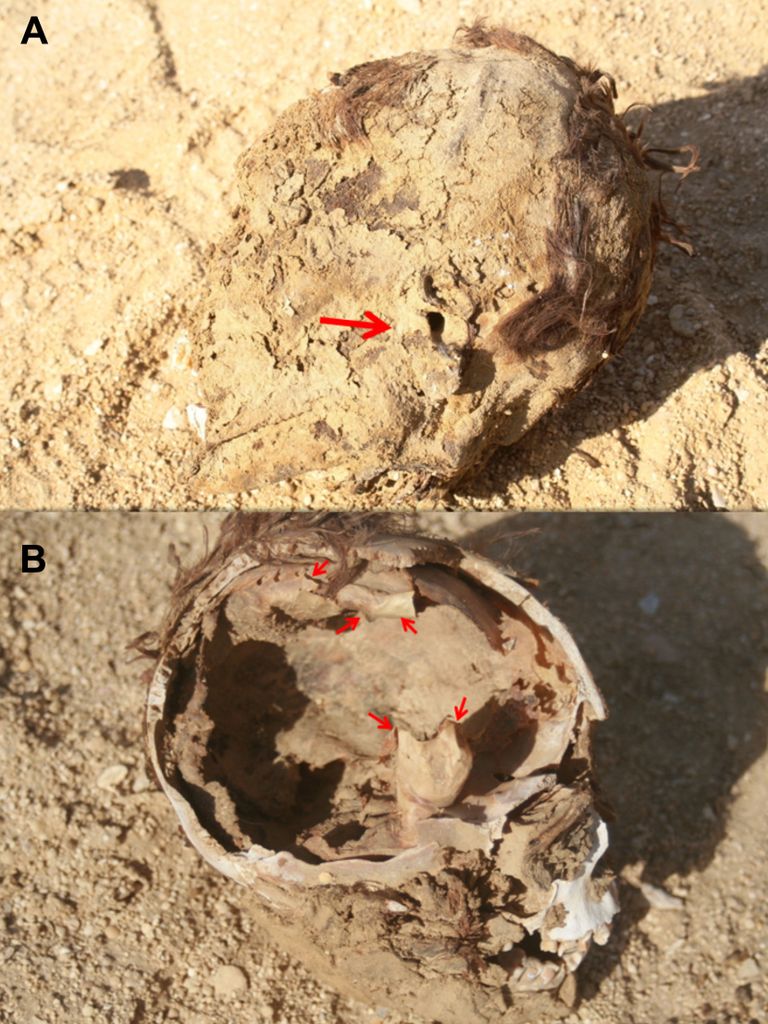 باحث يستعد لوضع مومياء مصرية داخل جهاز التصوير المقطعي المحوسب