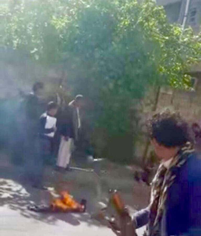 المعاق اليمني أحمد يحيى البعداني