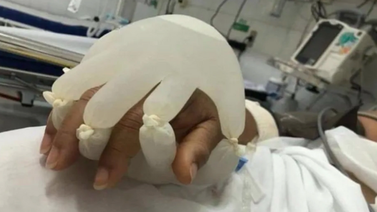 فيروس كورونا حصد أرواح 337 ألف شخص في البرازيل