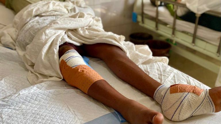 قذائف مليشيا الحوثي على منازل المدنيين