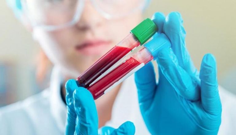 صورة لمتعافية من كورونا