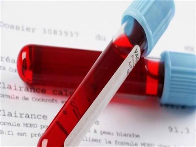 صورة لمتعافية من كورونا