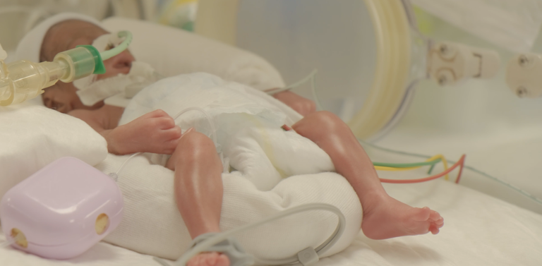 عملية الولادة تمت تحت إشراف 10 أطباء وعشرات الممرضين