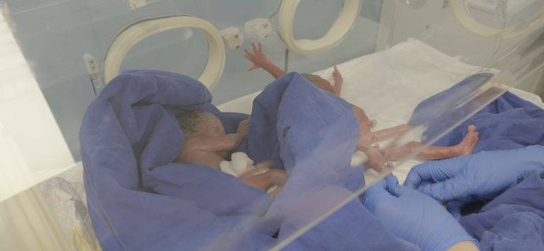 عملية الولادة تمت تحت إشراف 10 أطباء وعشرات الممرضين