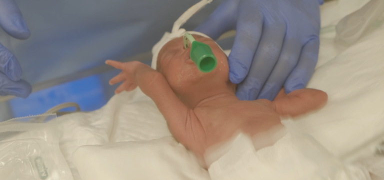 عملية الولادة تمت تحت إشراف 10 أطباء وعشرات الممرضين