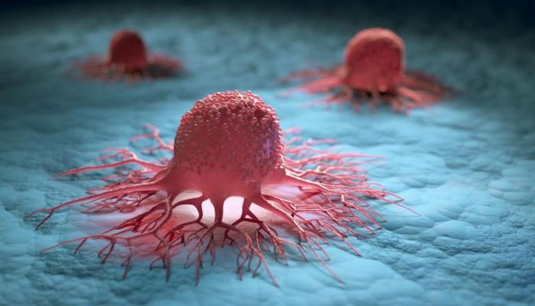 صورة تعبيرية عن الخلايا السرطانية