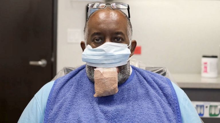 فيروس كورونا أنهك المرضى وفتح الباب لإصابتهم بأمراض نادرة