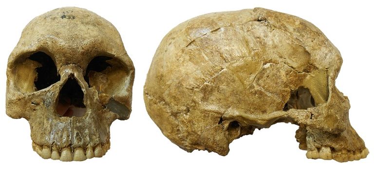 حملت بعض الرفات دلائل على جروح اندملت