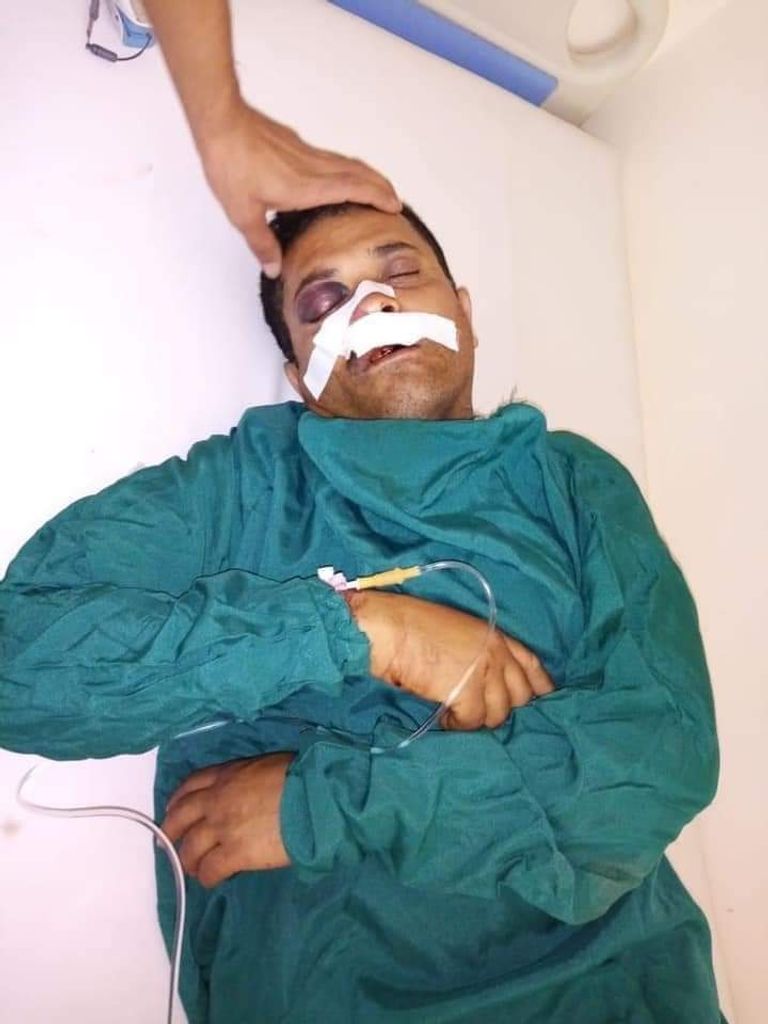 أحد الممرات على خطوط النار شمال الضالع.. أرشيف