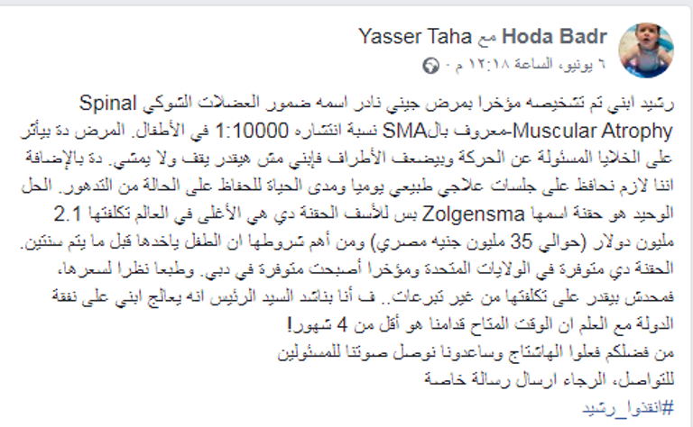 طفلة مصابة بمرض ضمور العضلات الشوكي