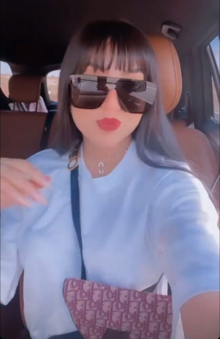 الفنانة المغربية دنيا بطمة بعد إجراء عمليات تجميل وتغيير في شكلها  الفنانة المغربية دنيا بطمة