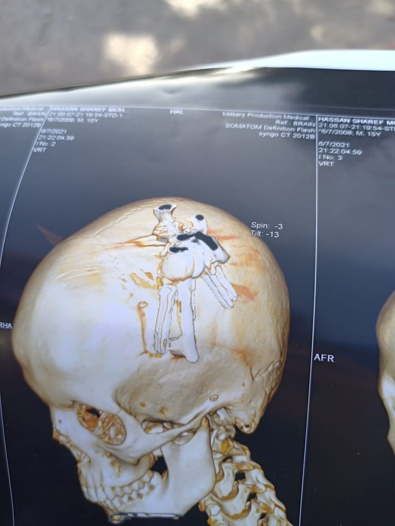 الطفل المصاب