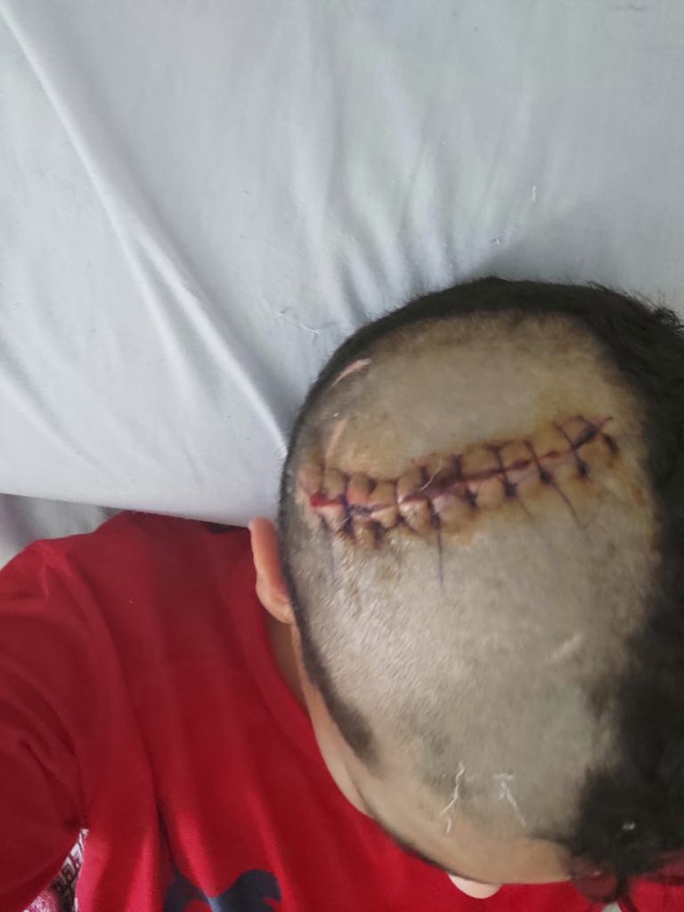 الطفل المصاب