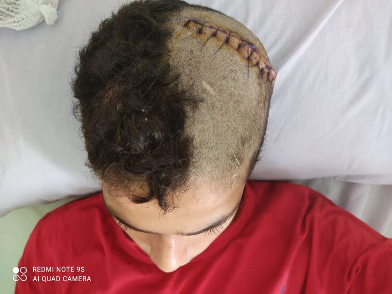 الطفل المصاب