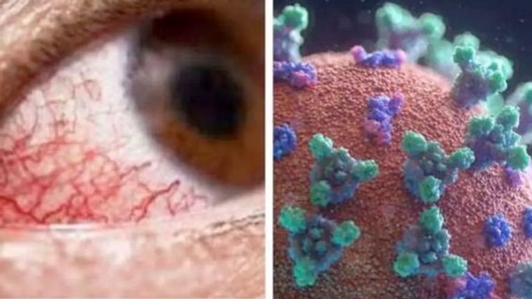 صورة تعبيرية للفطر الأسود