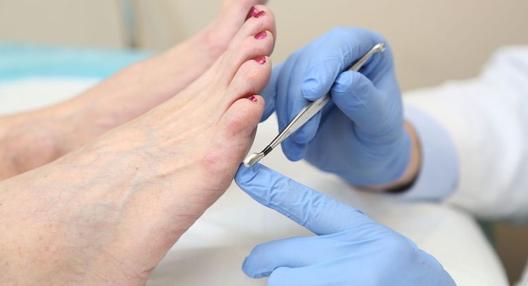 سيدة تعاني من مشكلة تلف أعصاب الرسغ