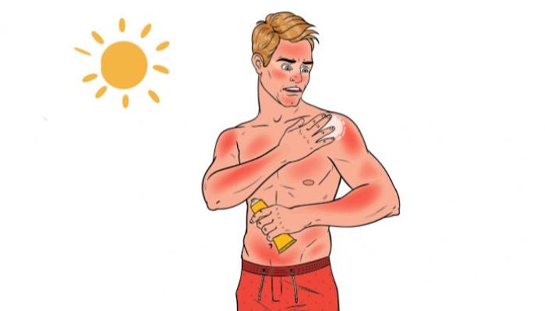 الحروق الشمسية ترفع خطر الإصابة بسرطان الجلد الأسود