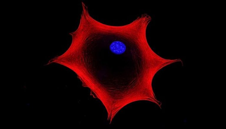 علماء يتوصلون إلى علاج للإيدز بالخلايا الجذعية- أرشيفية