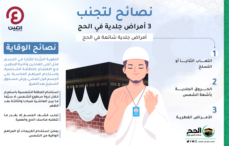 الحروق الجلدية بأشعة الشمس من الأمراض الشائعة في الحج