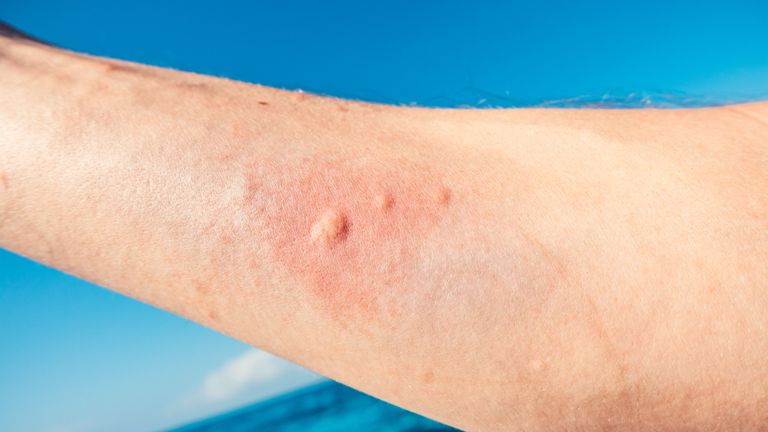 قناديل البحر