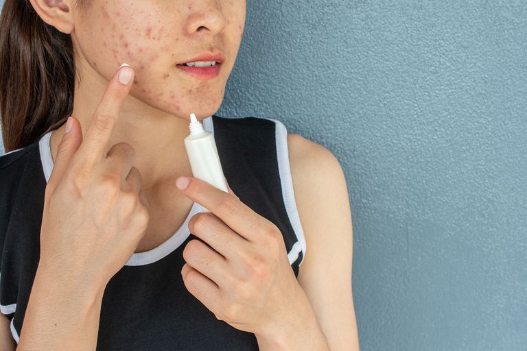 البثور الناجمة عن ارتداء الكمامة