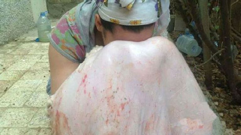 عادة مسح الوجه بجلد الخروف بعد سلخه في الجزائر فتاة جزائرية تمسح وجهها بجلد الخروف بعد سلخه - أرشيفية