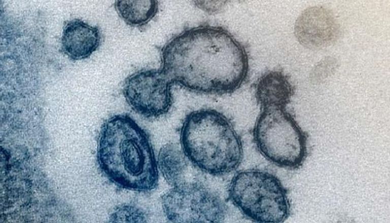جزيئات لفيروس كورونا معزولة من مريض