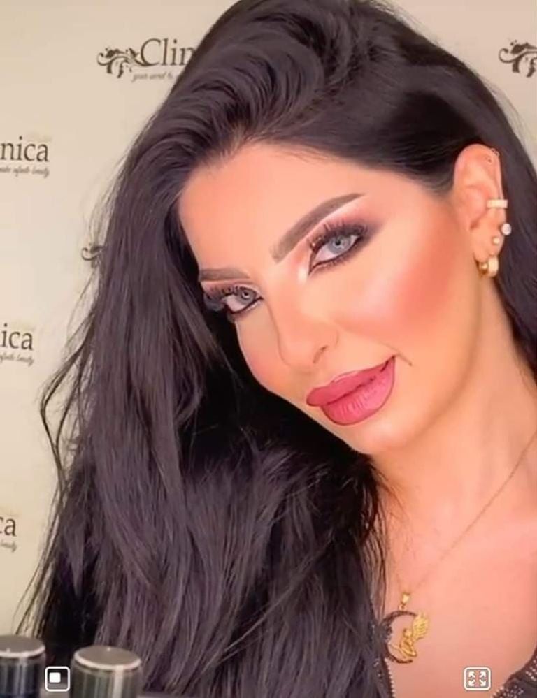 عمليات حقن البوتوكس والفيلر تنتشر بقوة في لبنان عمليات حقن البوتوكس والفيلر تنتشر بقوة في لبنان