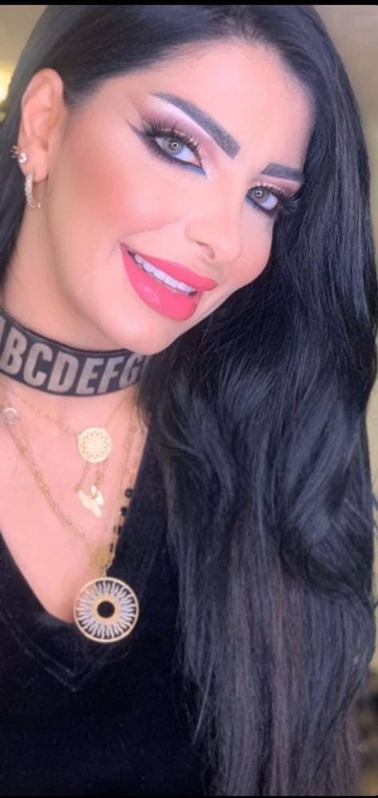 عمليات حقن البوتوكس والفيلر تنتشر بقوة في لبنان عمليات حقن البوتوكس والفيلر تنتشر بقوة في لبنان