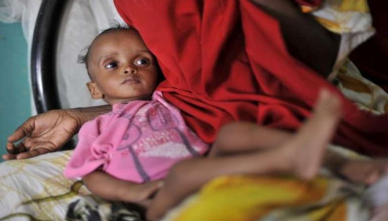 سوء التغذية الحاد يهدد الأطفال في إثيوبيا- أرشيفية