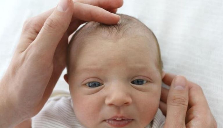 السكتة الدماغية تصيب واحدا من بين كل 4 آلاف مولود جديد