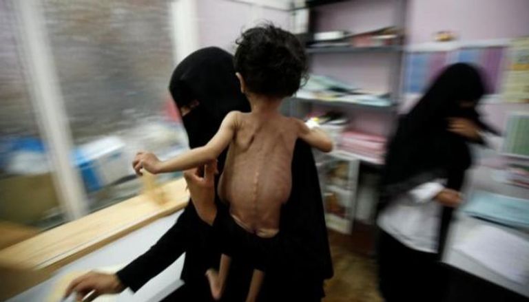 الجوع يهدد أطفال اليمن- أرشيفية
