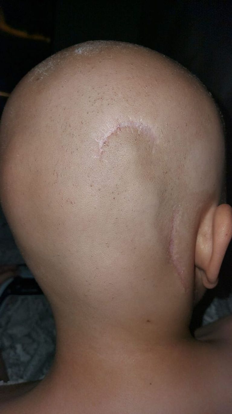 الطفل ديفيد لالي