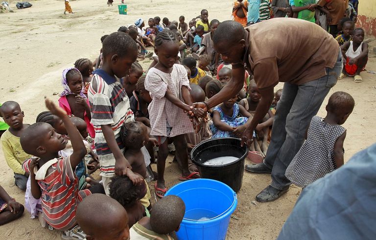 طفلة تعاني من مرض الكوليرا