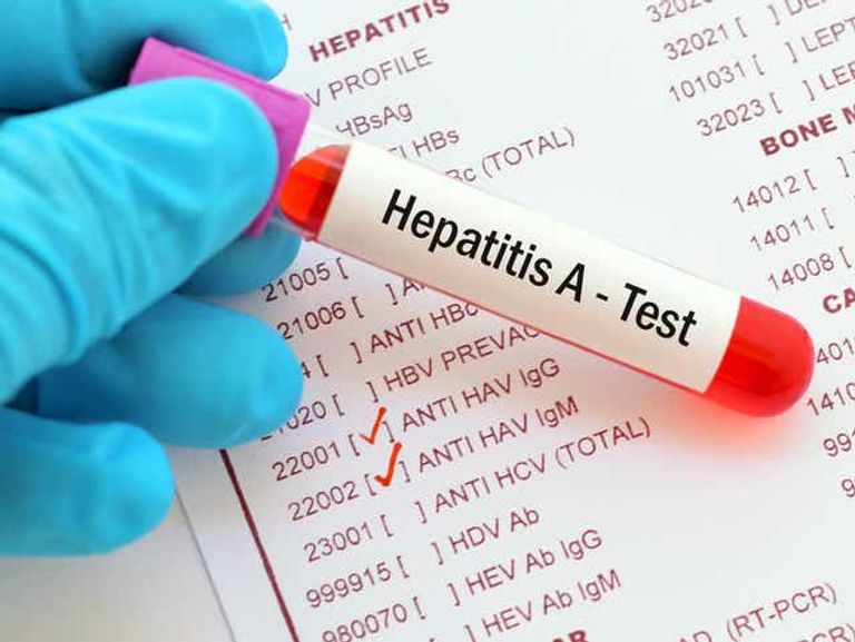 التوعك واضطرابات البطن من أهم أعراض التهاب الكبد الوبائي A